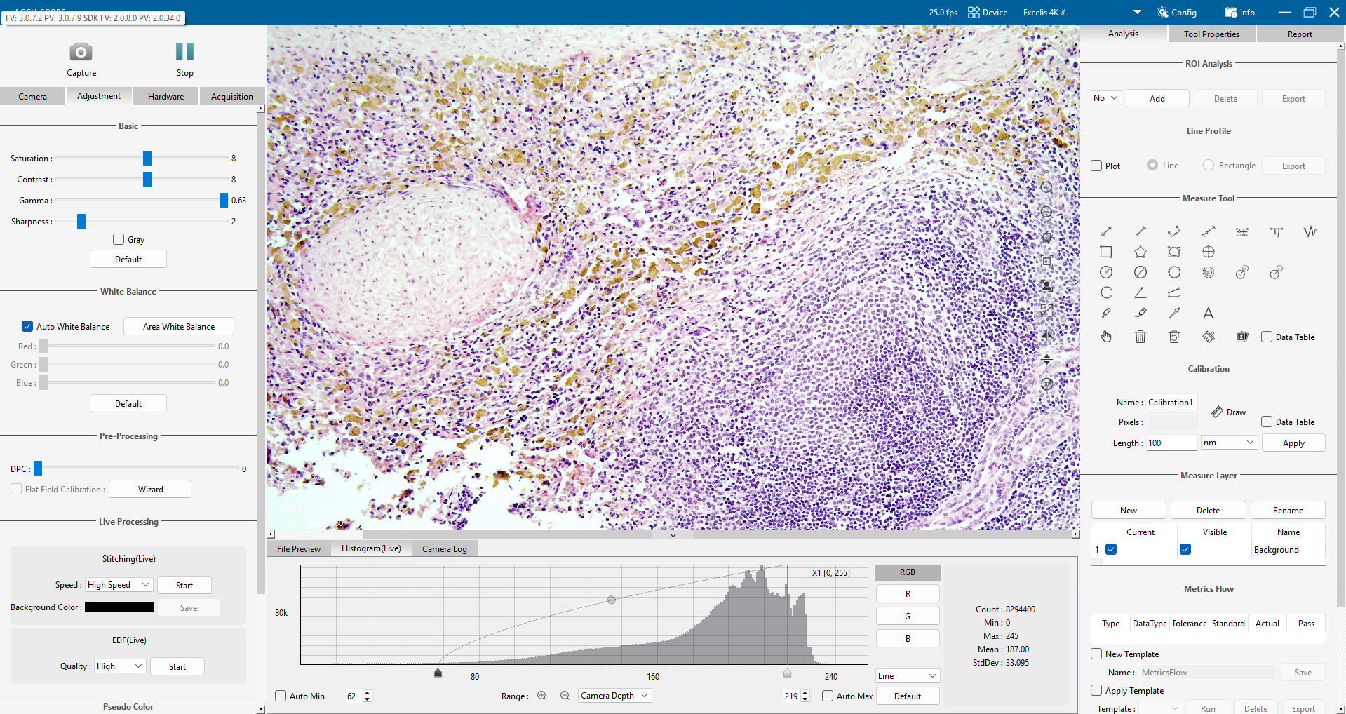 oncology - immunostain 10x