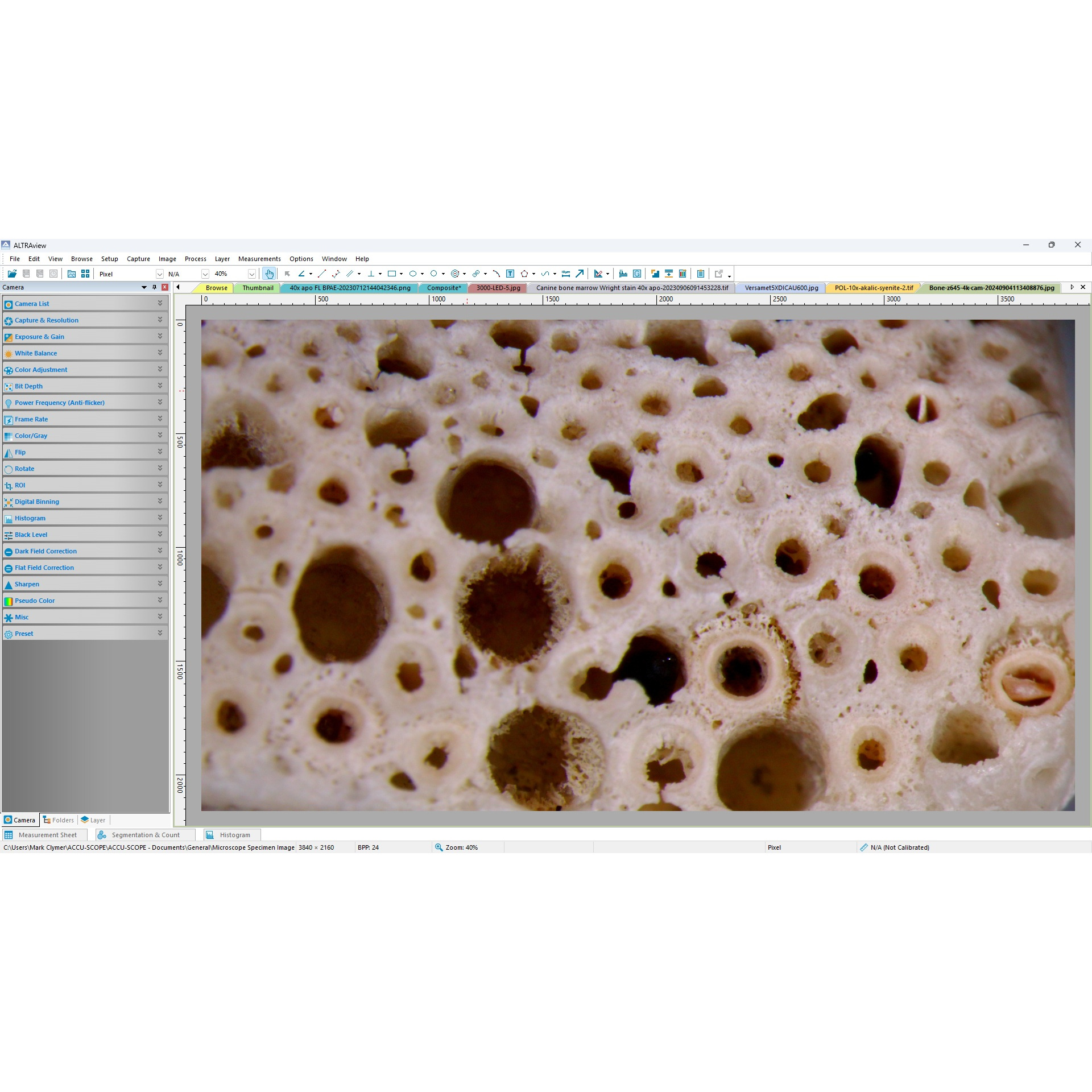 ALTRAview - BF - bone - square